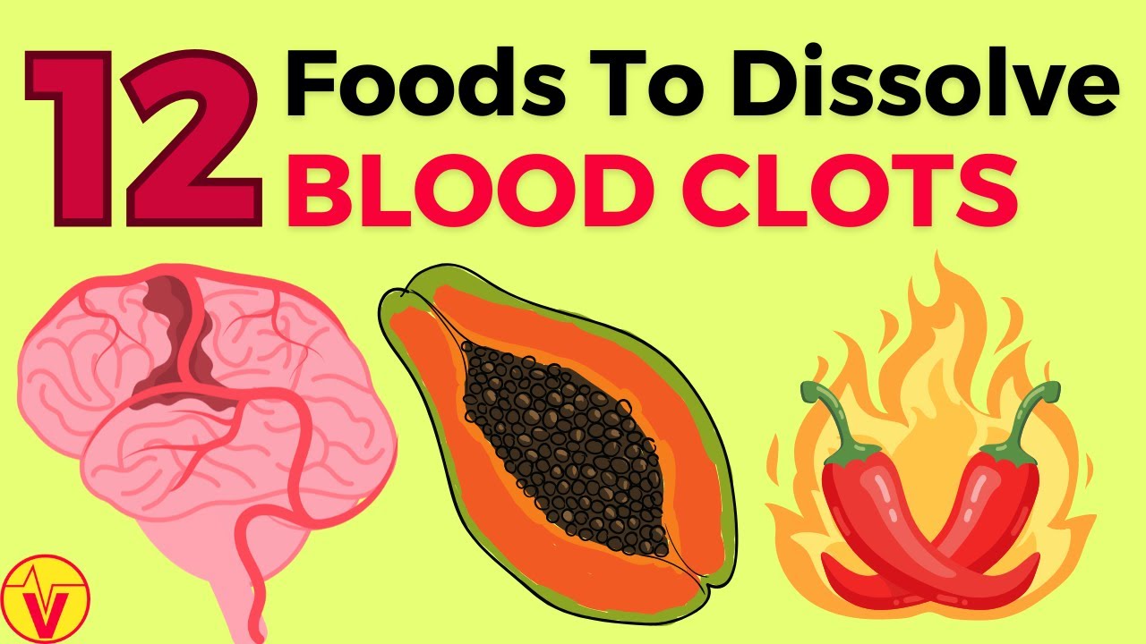 home remedies for blood clots