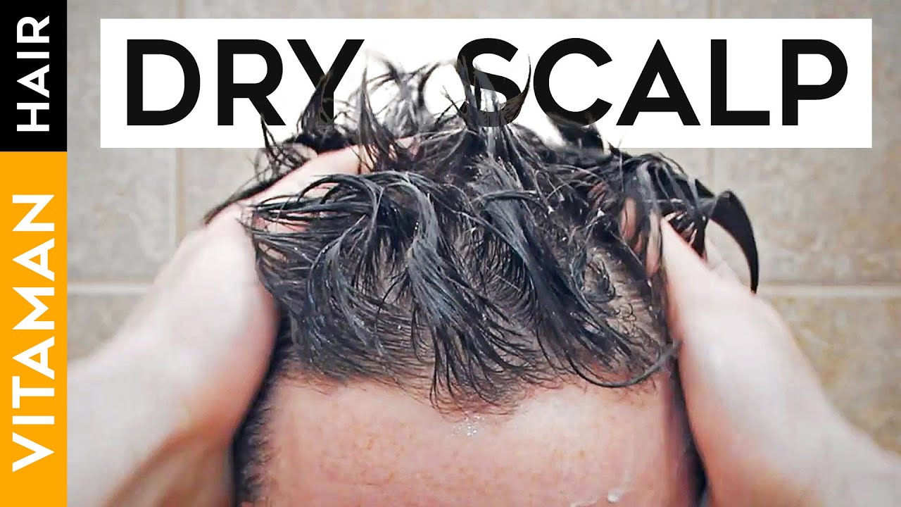 How to Fix Dry Scalp