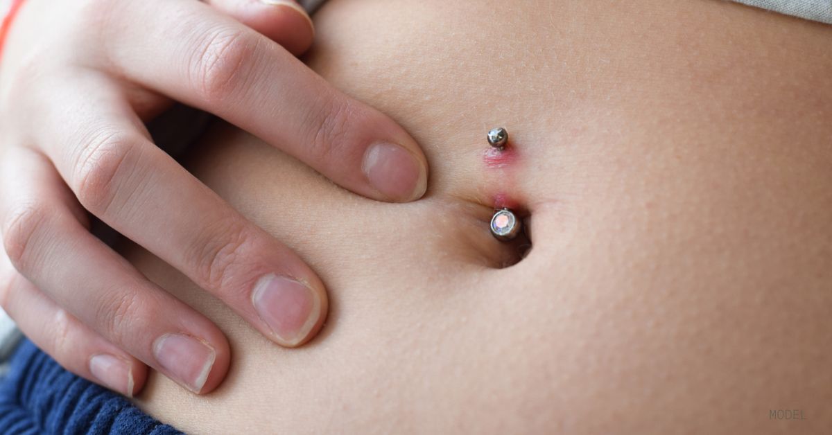 Effective Treatment for Piercing Bump