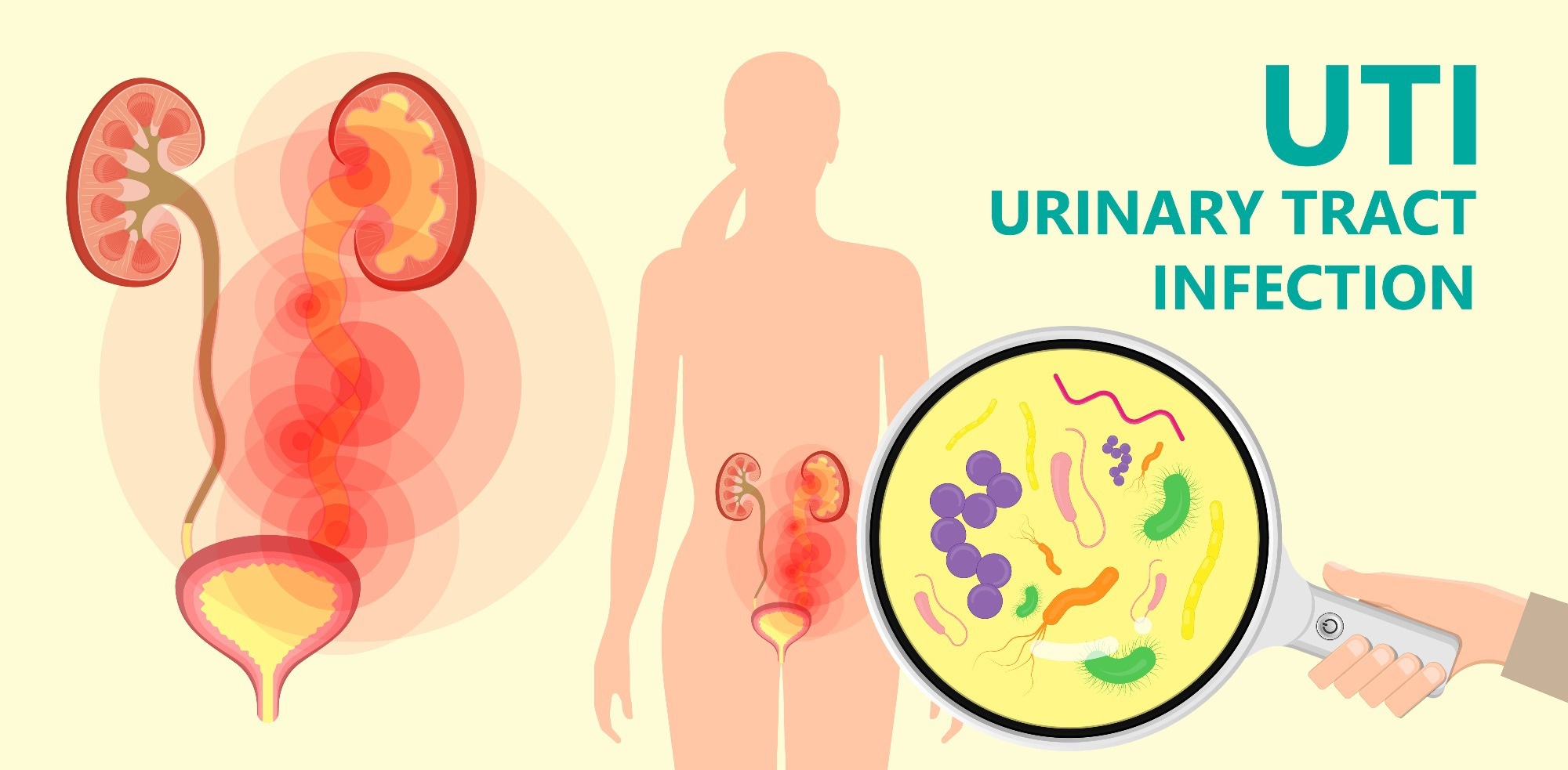 Effective UTI Relief Strategies